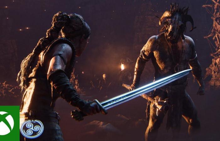 تقرير:
      إدارة
      Xbox
      تعتبر
      إصدار
      Hellblade
      2
      حصريًا
      قرارًا
      خاطئًا - غاية التعليمية